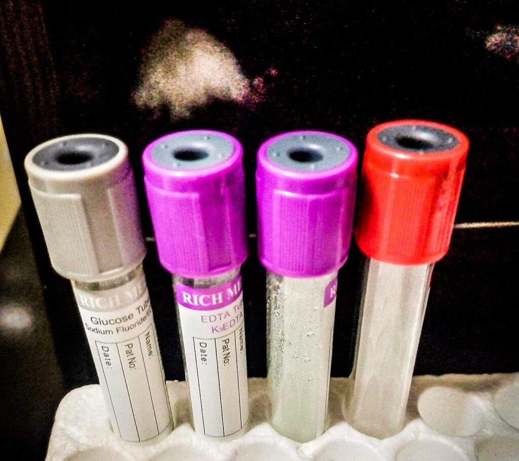 Blood Test Breakthrough: Crohn’s and Colitis Could Be Spotted 10 Years Early Colour-coded blood sample tubes standing in a laboratory rack